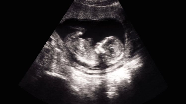 Könsselektiva aborter väcker starka reaktioner 
