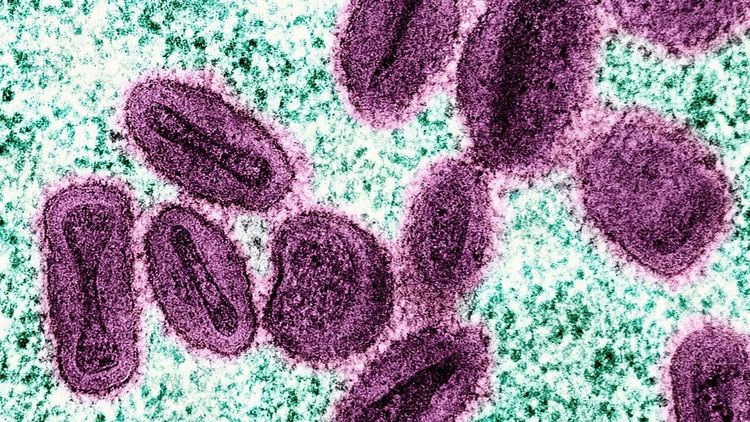 Ökning av smittsamt virus oroar i Bryssel