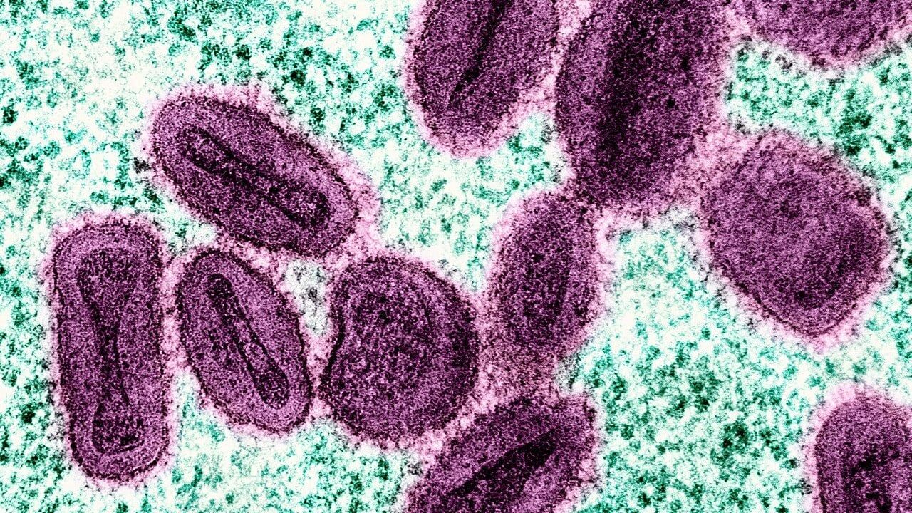Ökning av smittsamt virus oroar i Bryssel